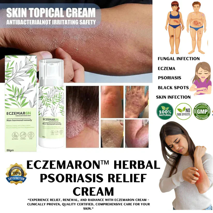 Noviq™️ Eczemaron Anti Fungal Cream v Spray | Buy 1 Get 1 Free