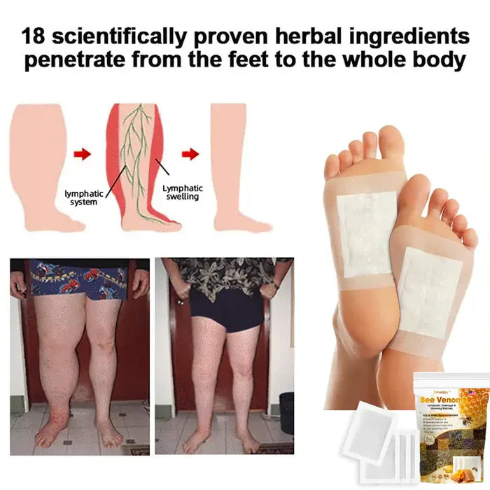 Bee Venom Lymphatic Drainage & Slimming Foot Patches with Free Relief Spray Oil